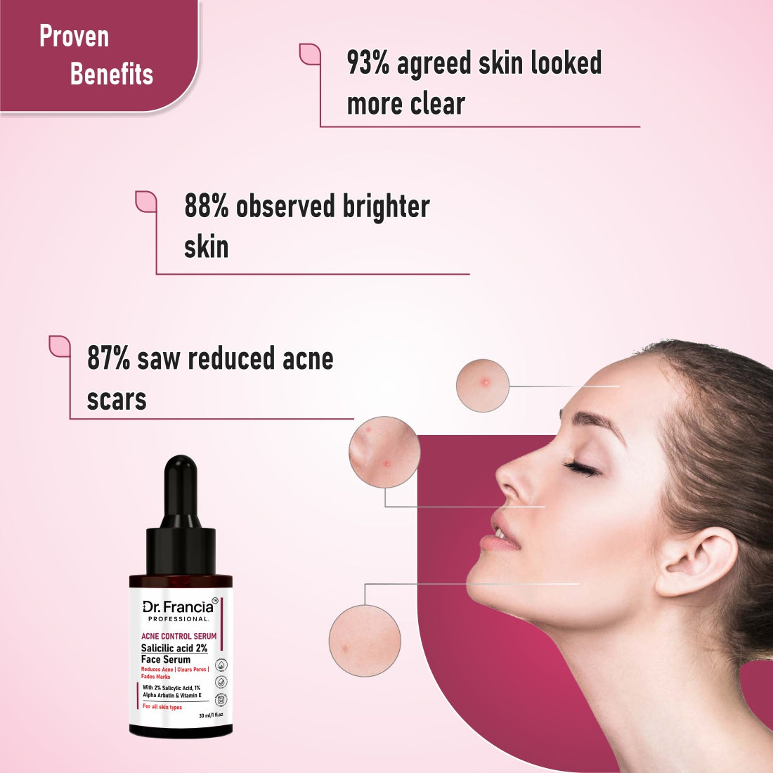 Dr. Francia Professional 2% Salicylic Acid Face Serum | Anti-Acne & Pore Clearing